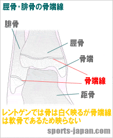 脛骨･腓骨の骨端線【イラスト図】